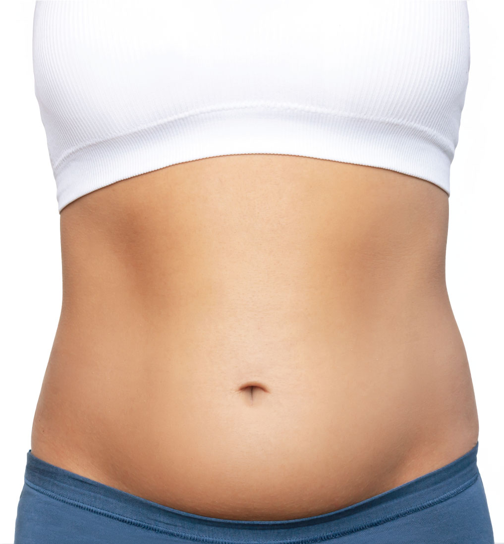 Before-Stubborn Belly Fat